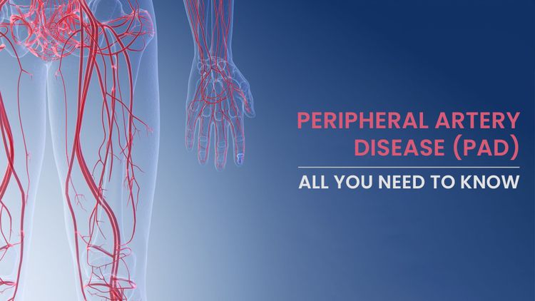 Peripheral Artery Disease treatment in Clearwater Florida