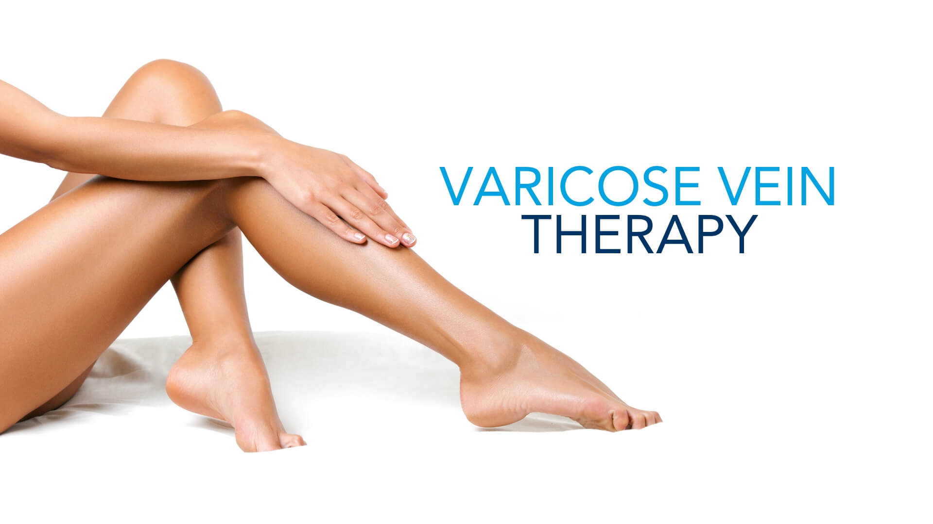 varicose veins